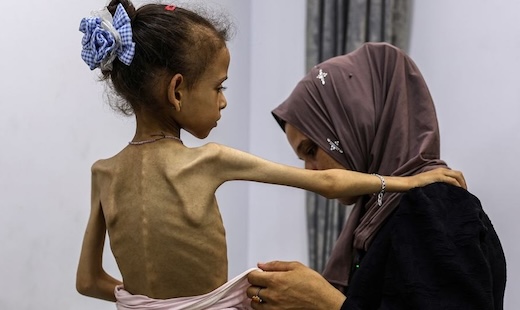 How the ‘Blood Libel’ Paradox Keeps the West Silent on Israel’s Genocide