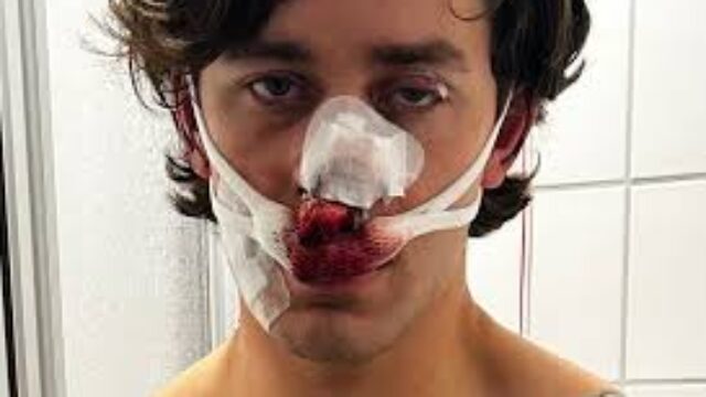 Migrants in Dresden Harass Women, Then Slash an American Man’s Face Open as He Tries to Intervene