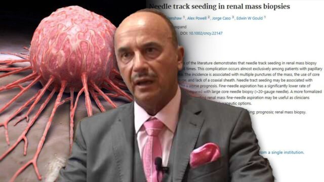 Doctor Who Cured 92% of Cancer Patients Says Biopsies Are SPREADING Cancer