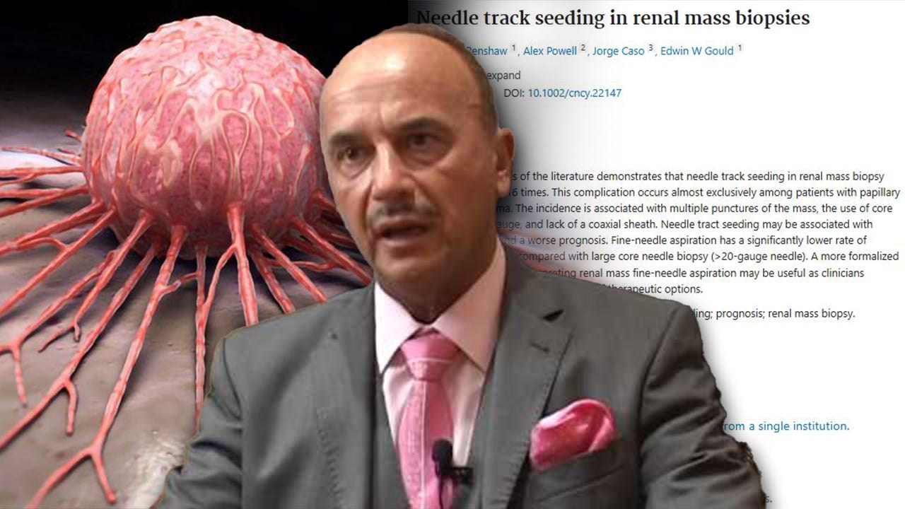Doctor Who Cured 92% of Cancer Patients Says Biopsies Are SPREADING Cancer